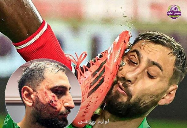 مصدومیت شدید دوناروما و تنها یک کارت زرد!
